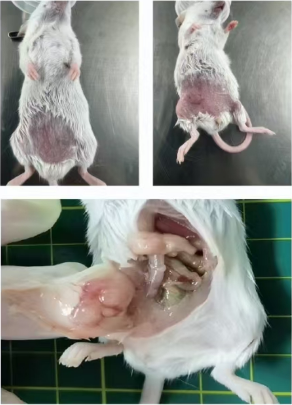 ◎ 乳腺癌-移植性乳腺癌原位型